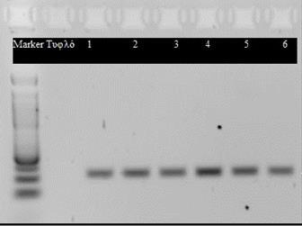 6.2 Ανίχνευση μεθυλίωσης του πρώτου υποκινητή του RASSF1 γονιδιου Πριν την ανίχνευση της μεθυλίωσης πραγματοποιήθηκε PCR και ελέχθηκαν τα προϊόντα για το σωστό μέγεθος και την καθαρότητα της
