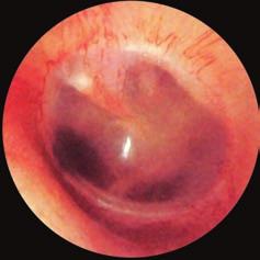 of Otology - Audiology - Neurootology www.