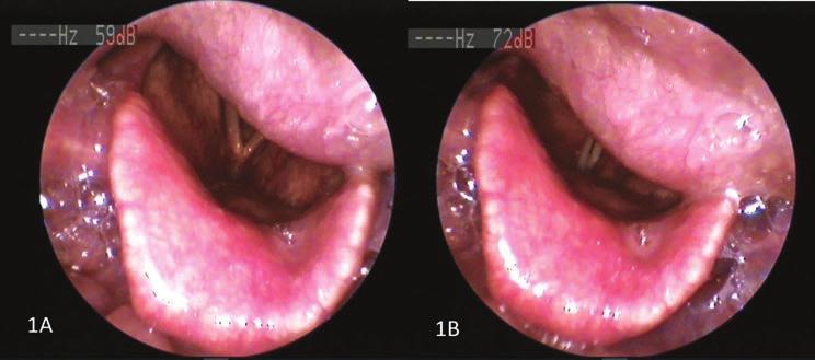 ΚΛΙΝΙΚΗ ΦΩΤΟΓΡΑΦΙΑ/ CLINICAL PHOTOGRAPH Τσακιράκη Ελένη Χειμώνα Θεογνωσία Λαδιάς Αλέξανδρος Παπαδάκης Χαρίτων Ωτορινολαρυγγολογική Κλινική, Γενικό Νοσοκομείο Χανίων Ελληνική Ωτορινολαρυγγολογία,