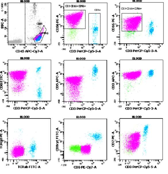 NK- LGL CD2+ CD56+ CD16+ CD8+ CD7+dim scd3-