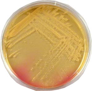 Staphylococcus aureus Growing on Mannitol Salt Agar.