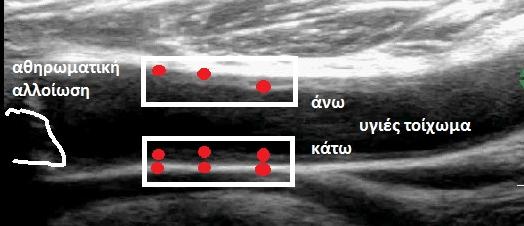 Οι εικόνες (δ)-(στ) απεικονίζουν τα αντίστοιχα σημεία που επιλέχθησαν για την ανάλυση της κίνησης.