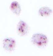 Acceptable pattern of staining in the NEQAS distributed negative cell line, showing strong distinct