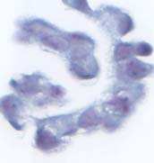 Unacceptable staining in the NEQAS amplified 3+ cell line.