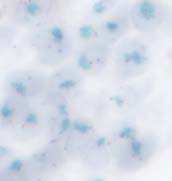 is real or actually nonspecific staining. The cells also show morphology damage. Fig 29.