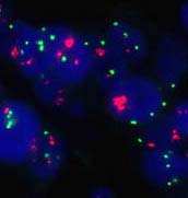 Acceptable pattern of staining in the NEQAS non-amplified 1+ cell line, showing bright distinct