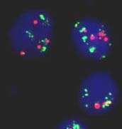 Borderline pass in the NEQAS distributed 2+ cell line.