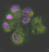 (Compare to the intensity of signals seen in Figs 3-32). Fig 34. NEQAS amplified 3+ cell line.