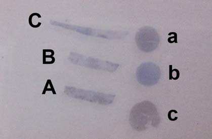 The Breast Hormonal Receptor Module Run 96 Suzanne Parry and Merdol Ibrahim Antigens Assessed: Oestrogen Receptors (ER) Tissue Sections circulated: Sections from a composite block (see table below)