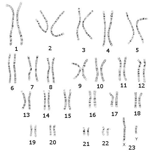 4 Εικόνα 2: 23 ζεύγη χρωµοσωµάτων τοποθετηµένα σύµφωνα µε το µέγεθος τους; Το χρωµόσωµα 1 είναι το µεγαλύτερο σε µέγεθος. Τα τελευταία 2 χρωµοσώµατα είναι τα φυλετικά χρωµοσώµατα.