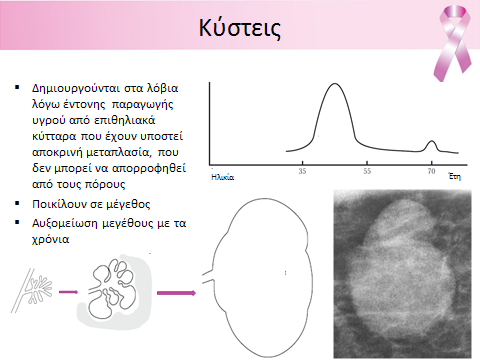 καλοήθη απεικόνιση μαστογραφικά.