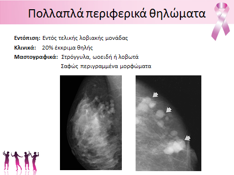 12 Ακτινολογικά Χρονικά, 1, 4 Τα πολλαπλά περιφερικά θηλώματα έχουν επί σης