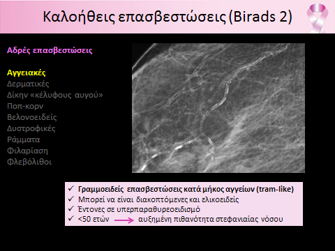 Γραμμοειδείς επασβεστώσεις κατά μήκος αγ γείων είναι χαρακτηριστικές αγγειακών