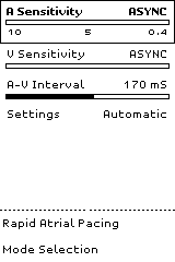 5.3.1 Sensitivity (Ευαισθησία) 5.3.1.1 A (Atrial) Sensitivity (Κολπική ευαισθησία) Εάν δεν προσαρμοστεί με μη αυτόματο τρόπο, η κολπική ευαισθησία (A Sensitivity) ρυθμίζεται στην ονομαστική τιμή των 0,5 mv.
