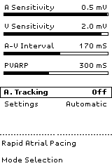 5.3.3 A. Tracking (Κολπική ρυμούλκηση) Η A.