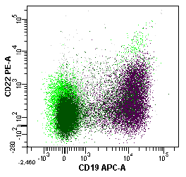 lysozyme+ CD15+CD34- Η αναγνώριση του χαρακτηριστικού ανοσοφαινοτυπικού προφίλ ή /και