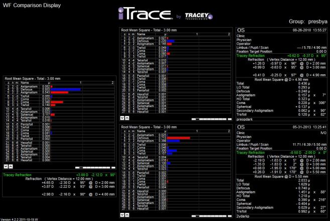 Corneal Topography της εταιρείας Tracey Technologies Corp, είναι το εκτροπόμετρο που χρησιμοποιήσαμε για τις μετρήσεις αυτής της μελέτης.