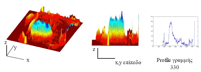 Spatial profiles Μια μέθοδος που μπορεί να χρησιμοποιηθεί για την παραμετροποίηση του contrast (της αντίθεσης) και της ανθρώπινης αντίληψης των δεδομένων ιατρικών εικόνων είναι η μέθοδος χωρικής