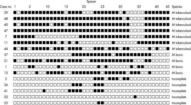 Spacer Oligonucleotide typing Γνλνηππηθή αλάιπζε κε βάζε ηνλ