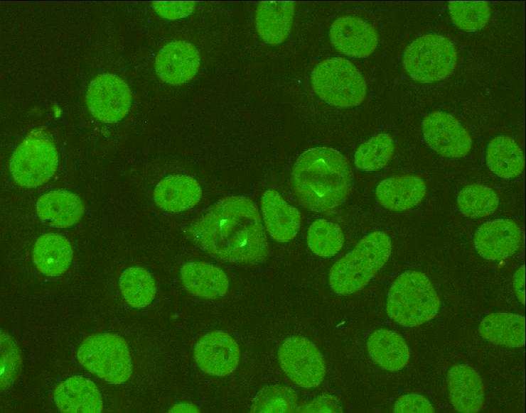 Μη-ειδικοί τύποι Nucleolar F.