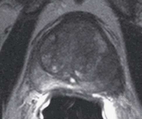 T2 AXIAL Ca αρ.