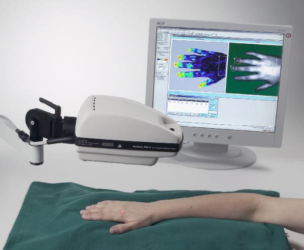 Απεικόνιση Λέιζερ Doppler (Laser Doppler imaging - LDI) Απεικόνιση της ροής του αίματος με Doppler Μη-επεμβατική χαρτογράφηση της ροής του αίματος στο δέρμα Δέσμη λέιζερ