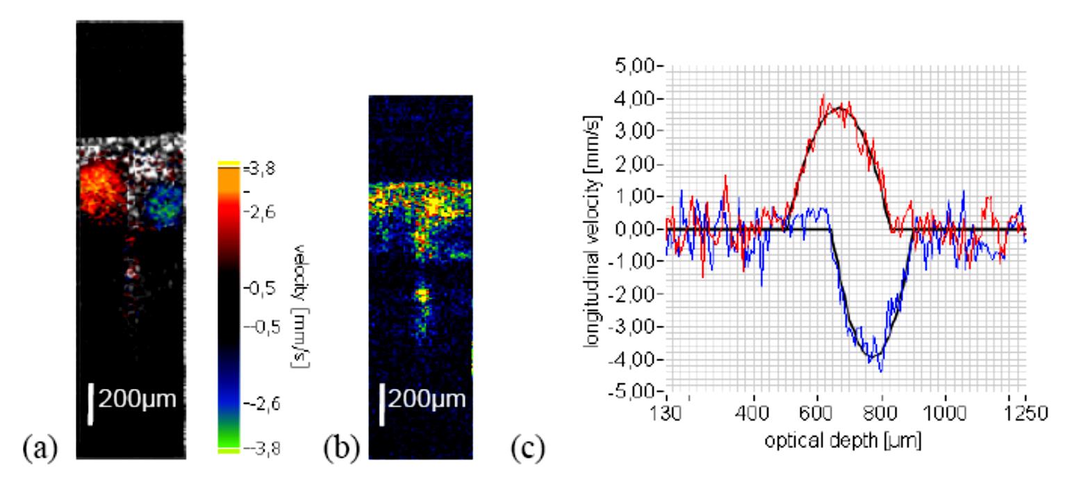 Doppler OCT Retinal