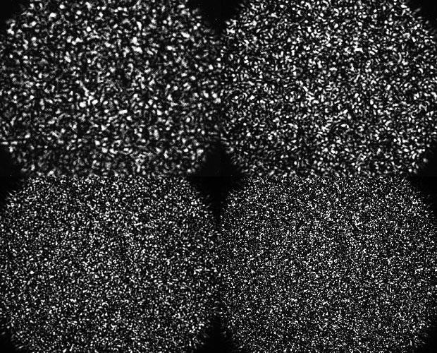 Laser Speckle Properties of speckle A random phenomenon which can only be described statistically The size of the individual speckles has in general nothing to do with the structure of the surface
