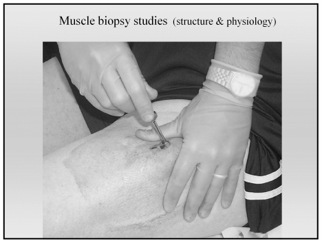 Muscle biopsy studies