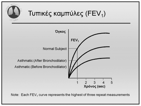 ΑΠΛΗ ΣΠΙΡΟΜΕΤΡΗΣΗ - ΤΕΧΝΙΚΗ Σπιρομέτρηση: σε φυσιολογικούς και σε ασθενείς με ΧΑΠ ΣΠΙΡΟΜΕΤΡΟ Τυπικές καμπύλες (FEV1) Όγκος FEV1 Normal Subject Asthmatic