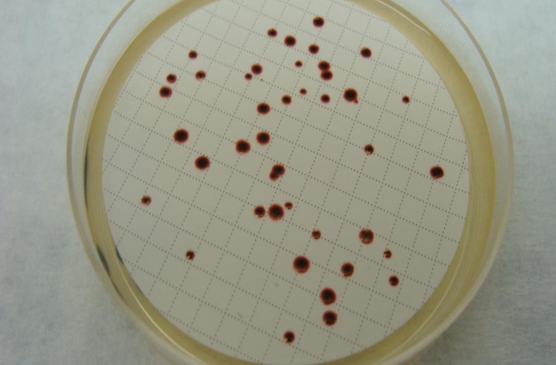 AΝΙΧΝΕΥΣΗ & ΑΡΙΘΜΗΣΗ ΕΝΤΕΡΟΚΟΚΚΩΝ (INTESTINAL) Τοποθέτηση κάθε μεμβράνης σε τρυβλίο Slanetz & Bartley agar