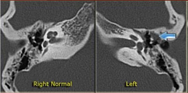 3mm Window Width/Window Level 4500/500 Intravenous Contrast (επί ενδείξεως) Multiplanar Reconstructions μη ιονικό 370 50mls με το χέρι αναμονή 5min axial 1-2mm