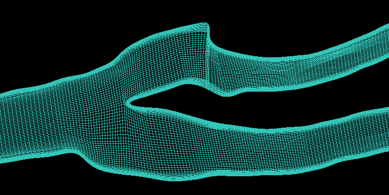 4. Διέγμηε ηα Scan-Planes Blocking Pre-Mesh Scan-Planes ρήκα 6.46: Δξγαιείν Scan-Planes ρήκα 6.