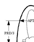 α) Strutt drive: Με