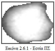 Γεσκεηξηθά ραξαθηεξηζηηθά [11] : Αθηίλα x : Αξρηθά παίξλνπκε ην θεληξηθό ζεκείν ηεο θαηαηκεζείζαο πεξηνρήο κε ηε βνήζεηα ηεο κεζόδνπ regionprops ε νπνία πξνζθέξεηαη από ην ινγηζκηθό matlab θαη ηεο