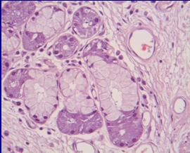 Βασικά κύτταρα τριχοειδή κυψελίδα Πνευµ. Τύπου ΙΙ Πνευµ.