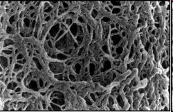 iii) Υξσκαηνγξαθία κνξηαθνύ απνθιεηζκνύ (molecular exclusion chromatography), Tα κόξηα ηνπ δείγκαηνο δηαρσξίδνληαη κε