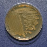 MALDI-TOF MS microorganism identification