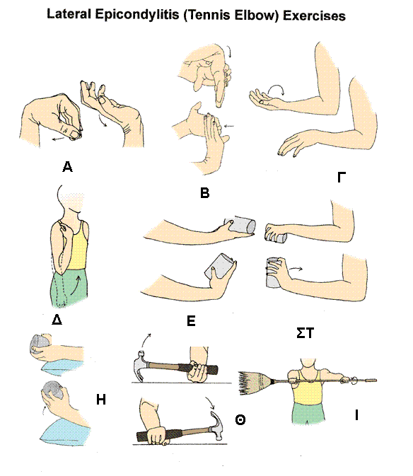 ΕΝΔΕΙΚΤΙΚΕΣ ΑΣΚΗΣΕΙΣ ΑΠΟΚΑΤΑΣΤΑΣΗΣ ΣΕ ΕΞΩ ΕΠΙΚΟΝΔΥΛΙΤΙΔΑ ΑΓΚΩΝΑ. Α. άσκηση για κάμψη- έκταση του καρπού (εύρος κίνησης) Β.