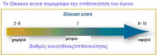 2.2.2 πλδπαζηηθό Δπίπεδν Gleason Όηαλ έλαο ηζηνπαζνιφγνο εμεηάδεη ηα πξνζηαηηθά δείγκαηα θαξθίλνπ θάησ απφ ην κηθξνζθφπην θαη ηα θαηαηάζζεη ζε επίπεδα Gleason, ζηελ πξαγκαηηθφηεηα ζα πξνζπαζήζεη