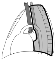 Χωρισμός του μεσοθωρακίου σε πρόσθιο, μέσο και οπίσθιο (από το Diagnostic Approach to Mediastinal Abnormalities. Camilla R.