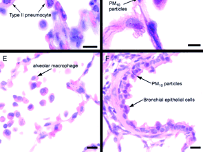 Figure1. Photomicrographs of formalin-fixed, paraffinembedded rabbit lung tissue stained with hematoxylin and eosin.