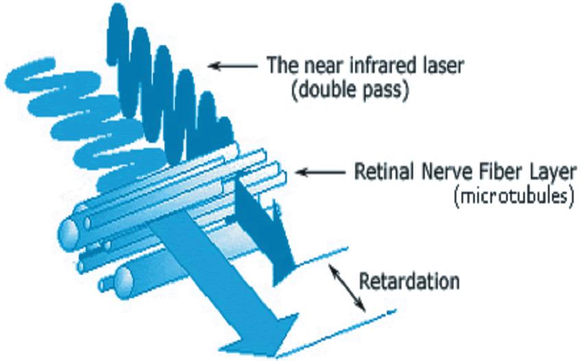 Λειτουργική (Functional) OCT OCT Ευαίσθητη στην Πόλωση (Polarization Sensitive) Ενισχυτική Συμβολή (Constructive