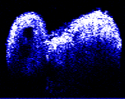 Ανάλυση Κόκκωσης (Speckle) Intensity image of nerve n v f Intensity image of tadpole Clustering