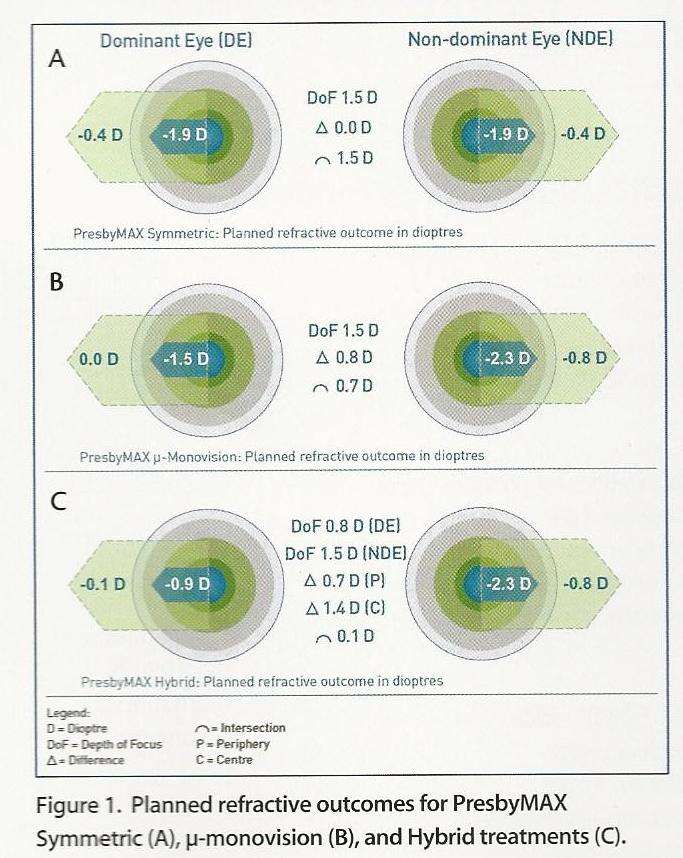 *Figure1: Cataract &