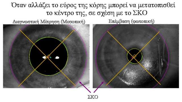 Πξεζβπσπηθή Γηόξζσζε