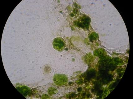 Η παρατήρηση του βιοφίλμ στο οπτικό μικροσκόπιο έδειξε μια σύνθετη μικροβιακή κοινότητα που αποτελείτο από gram θετικά (ιώδες χρώμα) και gram αρνητικά βακτήρια (κόκκινο χρώμα), μύκητες και μικροάλγη