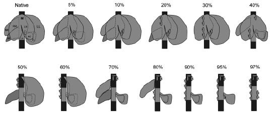 Ishizaki et al. 1999; Morioka, Watanabe et al. 2006; Martins and Neuhaus 2007) (εηθφλα 3.5) Δηθόλα 3.5: Υεηξνπξγηθή αλαηνκία ηνπ ήπαηνο ηνπ επίκπνο (ζπιαρληθή επηθάλεηα): Α.