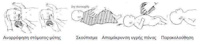 ΣΔΥΝΙΚΗ ΣΗ ΑΝΑΝΗΦΗ Παποσή Θεπμόηηηαρ: (ηνπνζέηεζε ηνπ λενγλνύ θάησ από ζεξκαληηθή πεγή δη αθηηλνβνιίαο) Σοποθέηηζη ηος νεογέννηηος: Σν λενγλό πξέπεη λα ηνπνζεηείηαη ζε ζέζε ύπηηα ή ζην πιάη κε ην