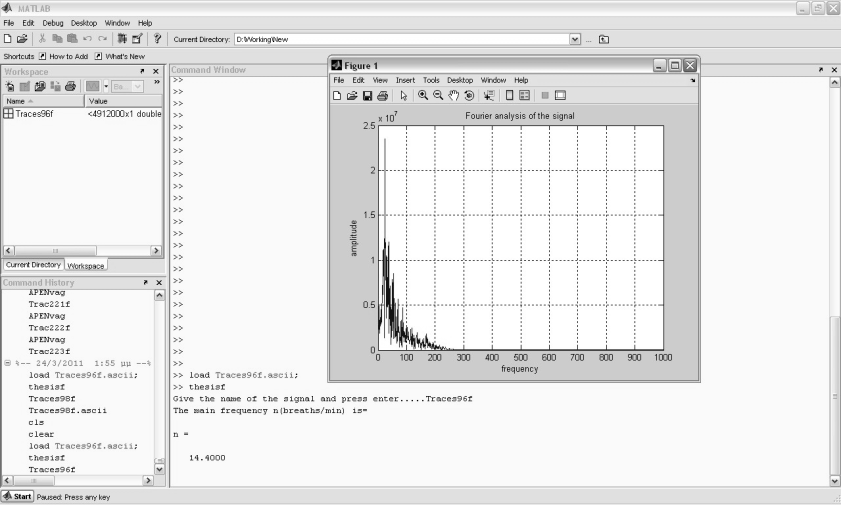 105 The main frequency n(breaths/min) is: n =19,8 Δικόνα 21: Γξαθηθή παξάζηαζε ηεο αλάιπζεο Fourier ελφο αλαπλεπζηηθνχ ζήκαηνο θαη ηαπηφρξνλε εμαγσγή ηνπ θπξίαξρνπ αλαπλεπζηηθνχ ξπζκνχ.